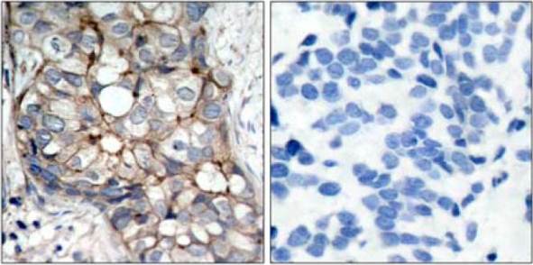 Immunohistochemistry (Formalin/PFA-fixed paraffin-embedded sections) - Anti-EGFR antibody (AB131498)
