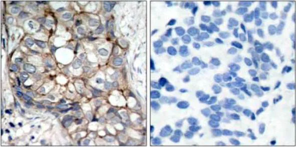 Immunohistochemistry (Formalin/PFA-fixed paraffin-embedded sections) - Anti-EGFR antibody (AB131498)