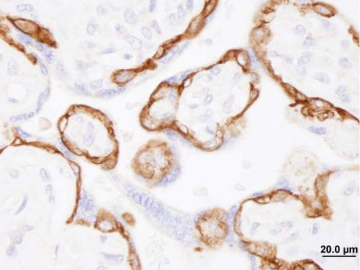 Immunohistochemistry (Formalin/PFA-fixed paraffin-embedded sections) - Anti-EGFR antibody (AB245363), expandable thumbnail