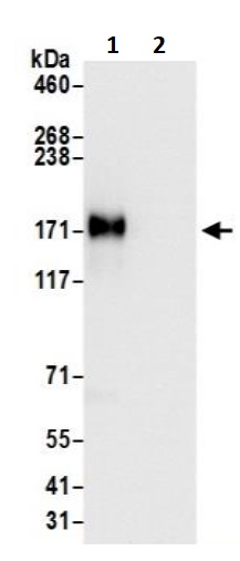 Immunoprecipitation - Anti-EGFR antibody (AB245363), expandable thumbnail
