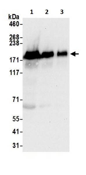 Western blot - Anti-EGFR antibody (AB245363), expandable thumbnail