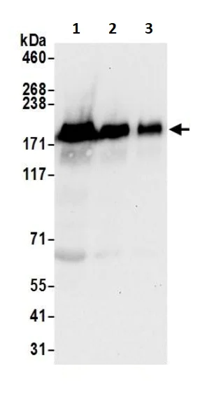 Western blot - Anti-EGFR antibody (AB245363)