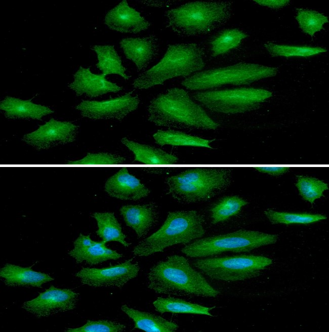 Immunocytochemistry/ Immunofluorescence - Anti-EGFR antibody [AT2H8] (AB265799)