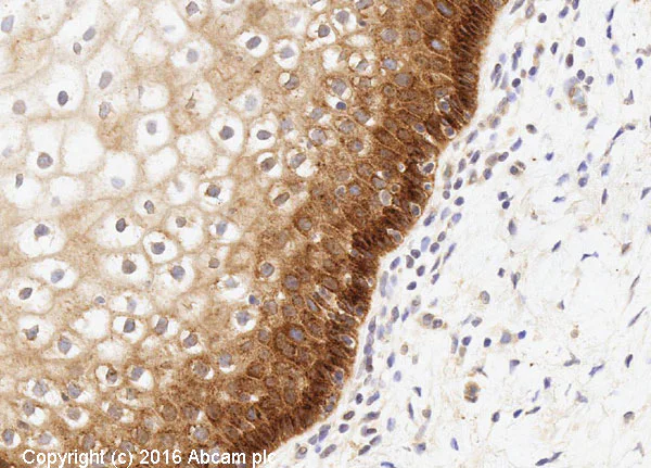 Immunohistochemistry (Formalin/PFA-fixed paraffin-embedded sections) - Anti-EGFR antibody [E114] (AB32562)