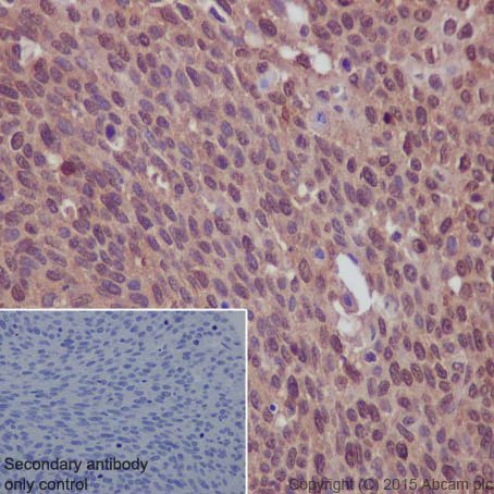 Immunohistochemistry (Formalin/PFA-fixed paraffin-embedded sections) - Anti-EGFR antibody [E114] (AB32562)