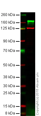 Western blot - Anti-EGFR antibody [E114] (AB32562)