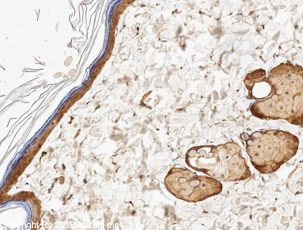 Immunohistochemistry (Formalin/PFA-fixed paraffin-embedded sections) - Anti-EGFR antibody [E114] - BSA and Azide free (AB271834)