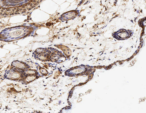 Immunohistochemistry (Formalin/PFA-fixed paraffin-embedded sections) - Anti-EGFR antibody [E114] - BSA and Azide free (AB271834)