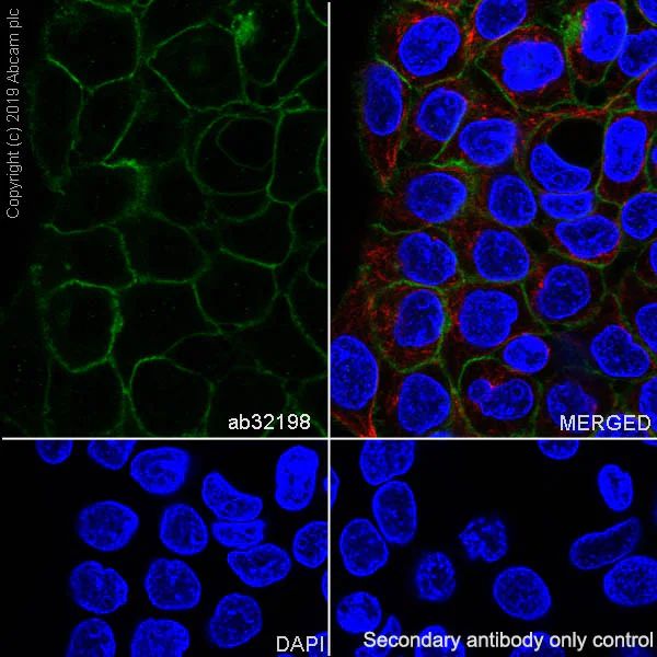 Immunocytochemistry/ Immunofluorescence - Anti-EGFR antibody [E234] (AB32198)