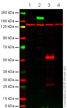 Western blot - Anti-EGFR antibody [E235] (AB32077)