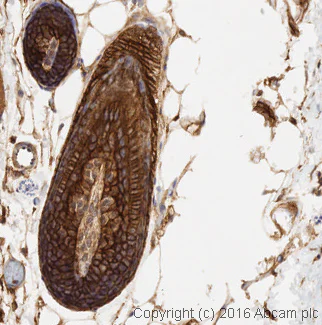 Immunohistochemistry (Formalin/PFA-fixed paraffin-embedded sections) - Anti-EGFR antibody [E235] - BSA and Azide free (AB227459)