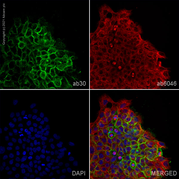 Immunocytochemistry/ Immunofluorescence - Anti-EGFR antibody [EGFR1] (AB30), expandable thumbnail