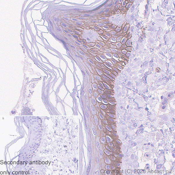 Immunohistochemistry (Formalin/PFA-fixed paraffin-embedded sections) - Anti-EGFR antibody [EMab-134] (AB264540)