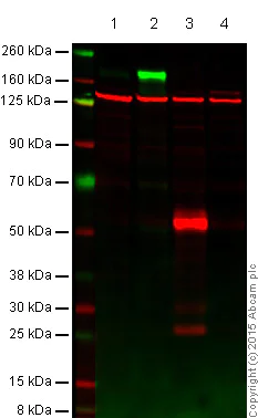 Western blot - Anti-EGFR antibody [EP38Y] (AB52894)