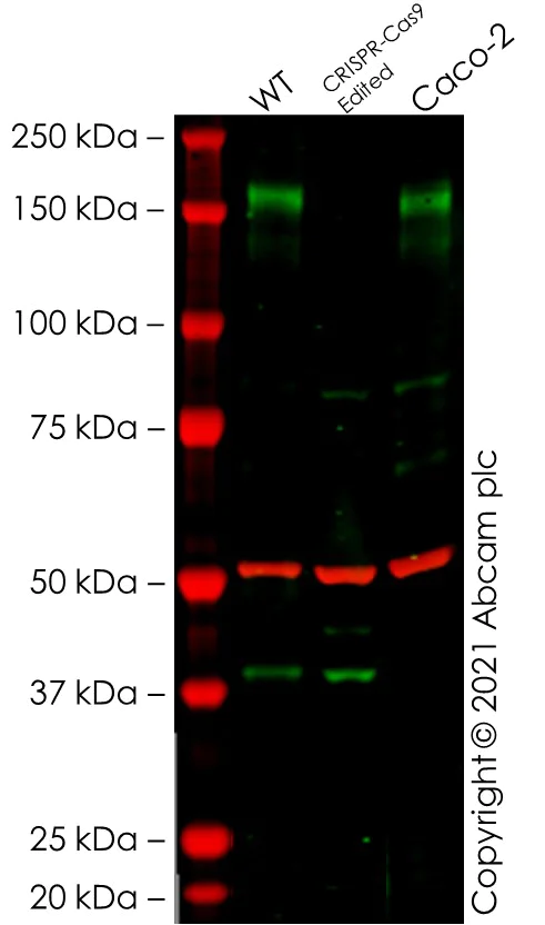 Western blot - Anti-EGFR antibody [EP38Y] (AB52894)