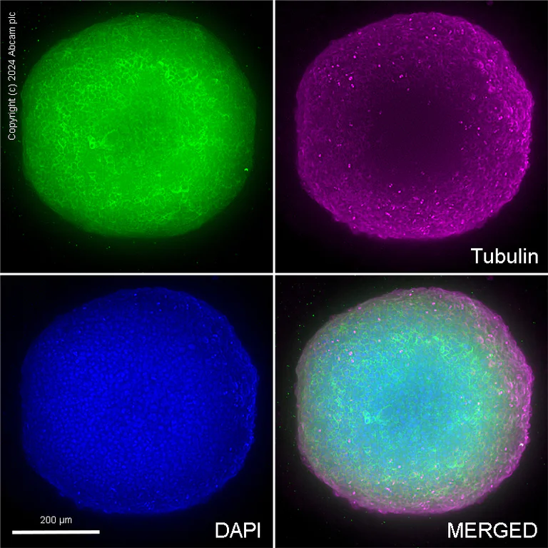 Immunocytochemistry/ Immunofluorescence - Anti-EGFR antibody [EP38Y] - BSA and Azide free (AB272293)