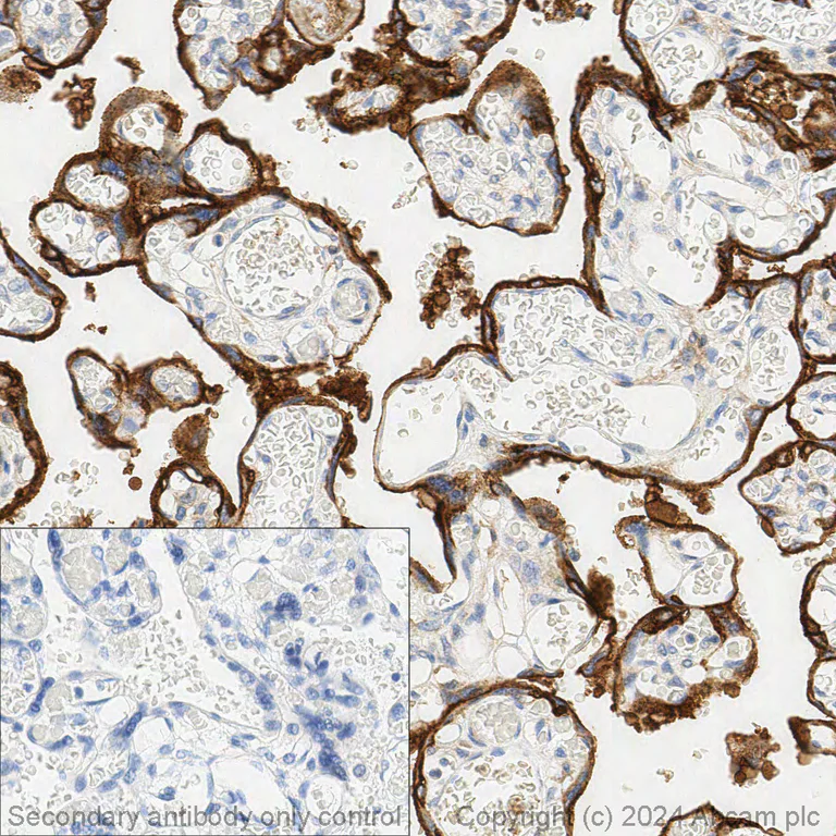 Immunohistochemistry (Formalin/PFA-fixed paraffin-embedded sections) - Anti-EGFR antibody [EP38Y] - BSA and Azide free (AB272293)