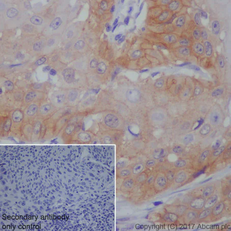 Immunohistochemistry (Formalin/PFA-fixed paraffin-embedded sections) - Anti-EGFR antibody [EP38Y] - Low endotoxin, Azide free (AB174481)