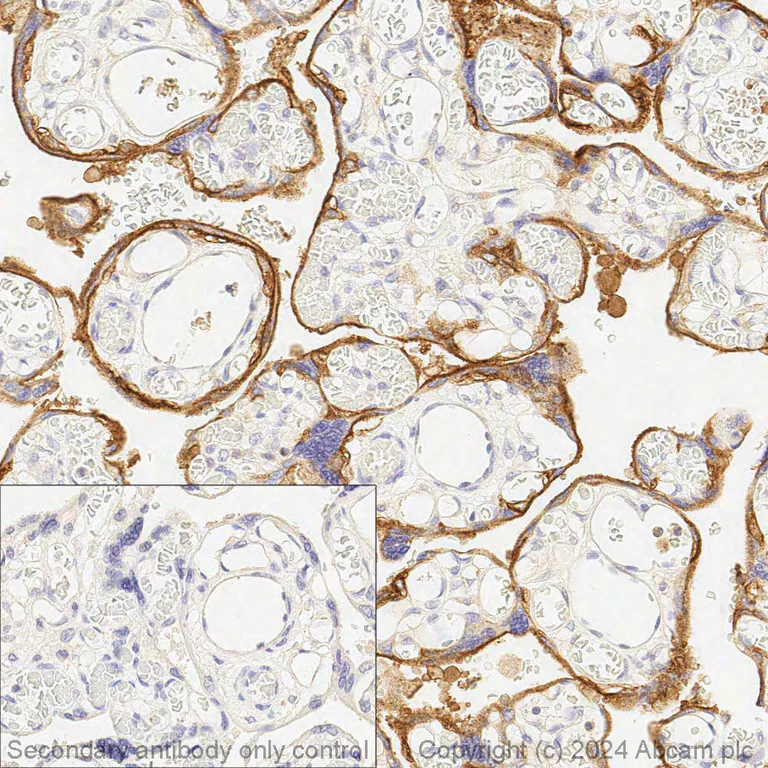 Immunohistochemistry (Formalin/PFA-fixed paraffin-embedded sections) - Anti-EGFR antibody [EP38Y] - Low endotoxin, Azide free (AB174481)