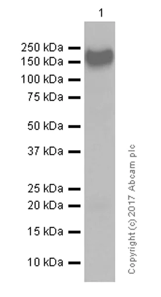 Western blot - Anti-EGFR antibody [EP38Y] - Low endotoxin, Azide free (AB174481)