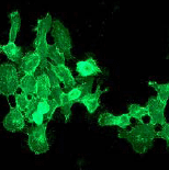 Immunocytochemistry/ Immunofluorescence - Anti-EGFR antibody [EPR39Y] (AB76153), expandable thumbnail