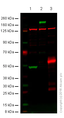 Western blot - Anti-EGFR antibody [EPR39Y] (AB76153)