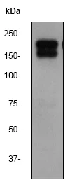 Western blot - Anti-EGFR antibody [EPR39Y] (AB76153)