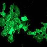 Immunocytochemistry/ Immunofluorescence - Anti-EGFR antibody [EPR39Y] - BSA and Azide free (AB239877), expandable thumbnail