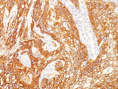Immunohistochemistry (Formalin/PFA-fixed paraffin-embedded sections) - Anti-EGFR antibody [GFR/2341] (AB237986)