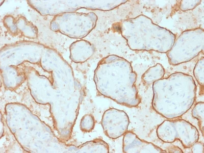 Immunohistochemistry (Formalin/PFA-fixed paraffin-embedded sections) - Anti-EGFR antibody [GFR/2341] (AB237986)