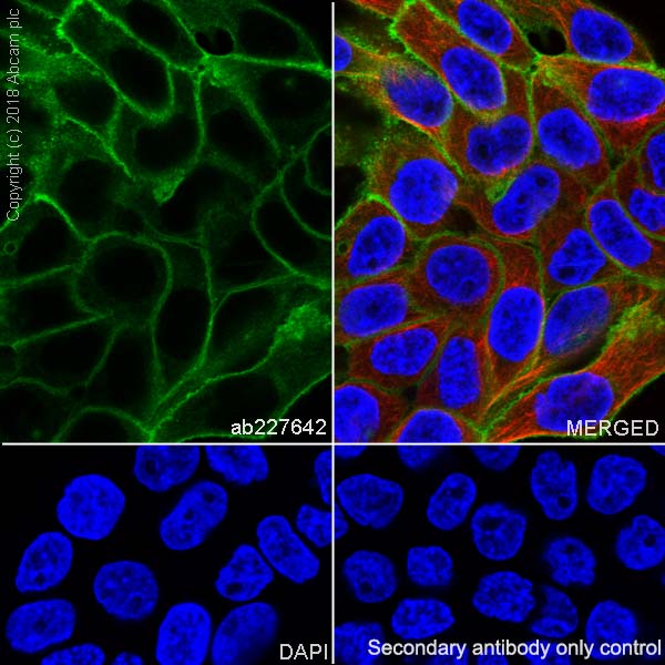 Immunocytochemistry/ Immunofluorescence - Anti-EGFR antibody [SP84] - C-terminal (AB227642), expandable thumbnail