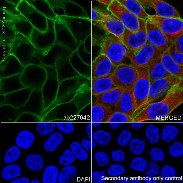 Immunocytochemistry/ Immunofluorescence - Anti-EGFR antibody [SP84] - C-terminal (AB227642)