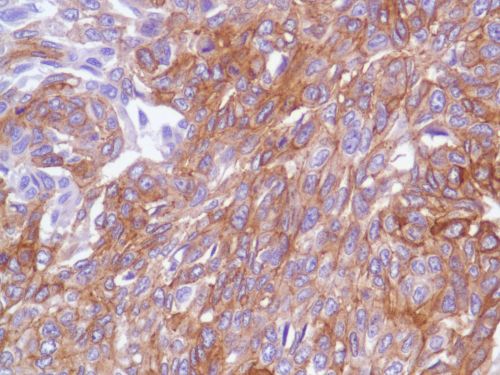 Immunohistochemistry (Formalin/PFA-fixed paraffin-embedded sections) - Anti-EGFR antibody [SP84] - C-terminal (ab227642), expandable thumbnail