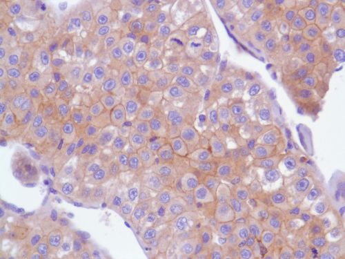 Immunohistochemistry (Formalin/PFA-fixed paraffin-embedded sections) - Anti-EGFR antibody [SP84] - C-terminal (ab227642), expandable thumbnail