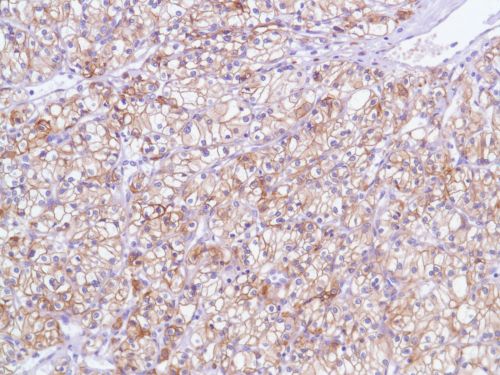 Immunohistochemistry (Formalin/PFA-fixed paraffin-embedded sections) - Anti-EGFR antibody [SP84] - C-terminal (ab227642), expandable thumbnail