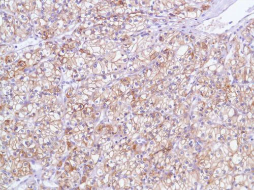 Immunohistochemistry (Formalin/PFA-fixed paraffin-embedded sections) - Anti-EGFR antibody [SP84] - C-terminal (AB227642)