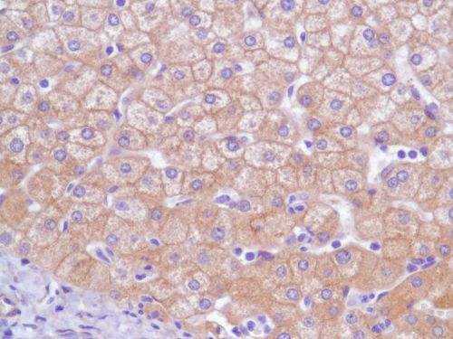 Immunohistochemistry (Formalin/PFA-fixed paraffin-embedded sections) - Anti-EGFR antibody [SP84] - C-terminal (ab227642), expandable thumbnail