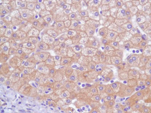 Immunohistochemistry (Formalin/PFA-fixed paraffin-embedded sections) - Anti-EGFR antibody [SP84] - C-terminal (AB227642)