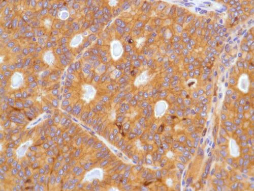 Immunohistochemistry (Formalin/PFA-fixed paraffin-embedded sections) - Anti-EGFR antibody [SP84] - C-terminal (AB227642)