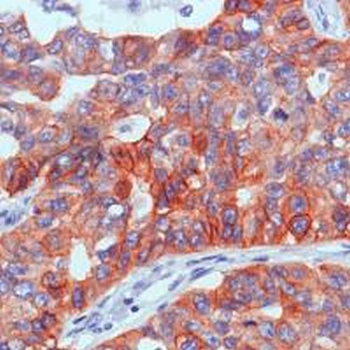 Immunohistochemistry (Formalin/PFA-fixed paraffin-embedded sections) - Anti-EGFR antibody [SP84] - C-terminal (AB227642), expandable thumbnail