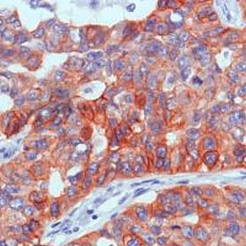 Immunohistochemistry (Formalin/PFA-fixed paraffin-embedded sections) - Anti-EGFR antibody [SP84] - C-terminal (AB227642)