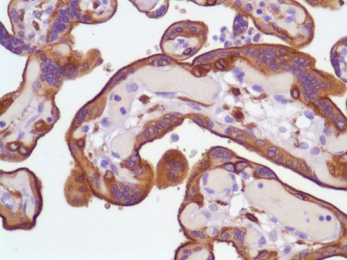 Immunohistochemistry (Formalin/PFA-fixed paraffin-embedded sections) - Anti-EGFR antibody [SP84] - C-terminal (ab227642), expandable thumbnail