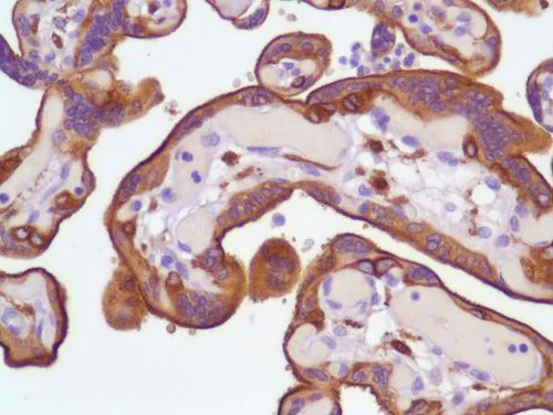 Immunohistochemistry (Formalin/PFA-fixed paraffin-embedded sections) - Anti-EGFR antibody [SP84] - C-terminal (AB227642)