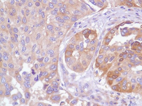 Immunohistochemistry (Formalin/PFA-fixed paraffin-embedded sections) - Anti-EGFR antibody [SP84] - C-terminal (AB227642), expandable thumbnail