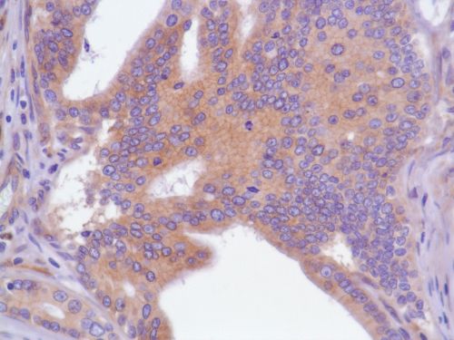 Immunohistochemistry (Formalin/PFA-fixed paraffin-embedded sections) - Anti-EGFR antibody [SP84] - C-terminal (ab227642), expandable thumbnail