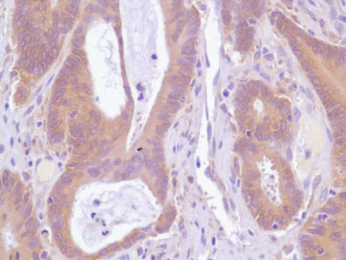 Immunohistochemistry (Formalin/PFA-fixed paraffin-embedded sections) - Anti-EGFR antibody [SP84] - C-terminal (AB227642)