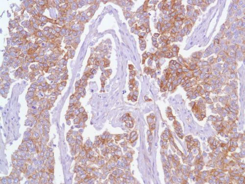 Immunohistochemistry (Formalin/PFA-fixed paraffin-embedded sections) - Anti-EGFR antibody [SP84] - C-terminal (AB227642)
