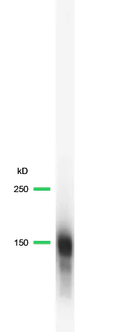 Western blot - Anti-EGFR antibody [SP84] - C-terminal (AB227642)