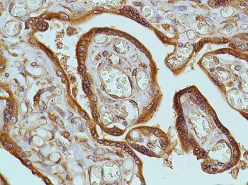 Immunohistochemistry (Formalin/PFA-fixed paraffin-embedded sections) - Anti-EGFR antibody [SP9] (AB231434)