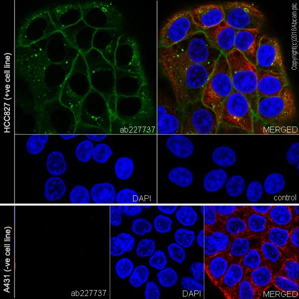 Immunocytochemistry/ Immunofluorescence - Anti-EGFR (deleted E746 + L747 + R748 + E749 + A750) antibody [SP111] (AB227737)